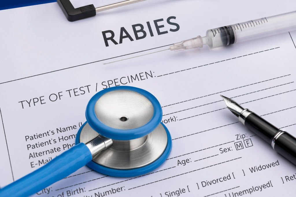 rabies test